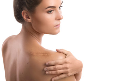 Лучшие мази от шрамов Лучшие мази от шрамов